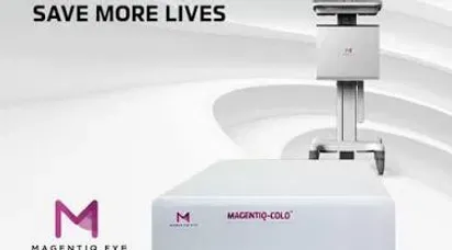 Endoscopy device promotion showing an AI detection overlay